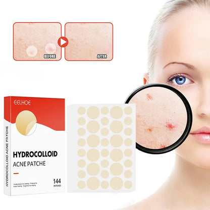 Acne Pimple Patch Set