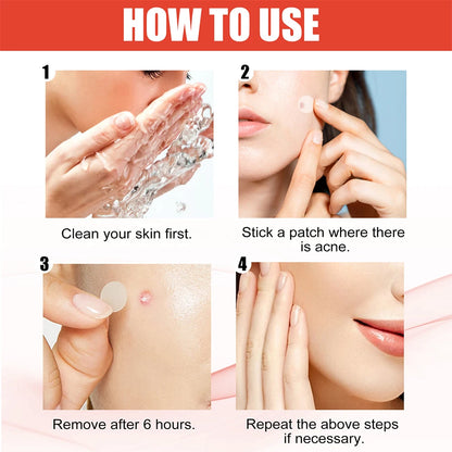 Acne Pimple Patch Set